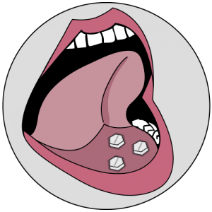 sublingual compramisotrol